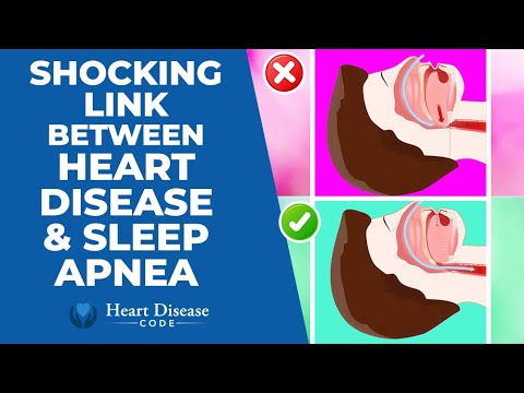 SHOCKING Link Between Heart Disease and Sleep Apnea